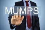 Mumps virus outbreak